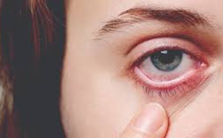 मोतियाबिंद का ऑपरेशन नहीं करा पा रहे हैं तो शिविर में मुफ्त कराइए