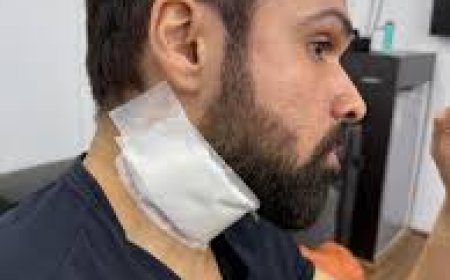 इमरान हाशमी को शूटिंग के दौरान लगी गंभीर चोट