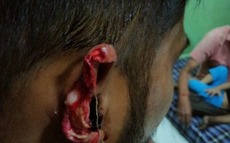 जब कटे कान के साथ न्यू आगरा थाने पहुंचा एक युवक