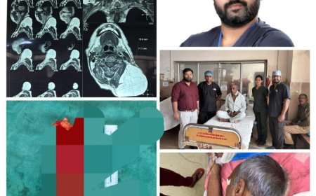 एसएन में गर्दन के दुर्लभ और विशाल ट्यूमर की सफल सर्जरी