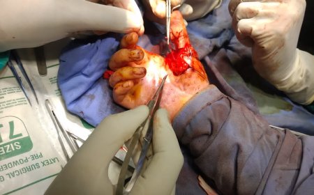 स्कूल में खेलते वक्त बच्ची का अंगूठा कट गया, लटके अंगूठे के साथ स्कूल वालों ने घर भेज दिया, इस खबर को पढ़कर आप गुस्से से आग बबूला हो जाएंगे!