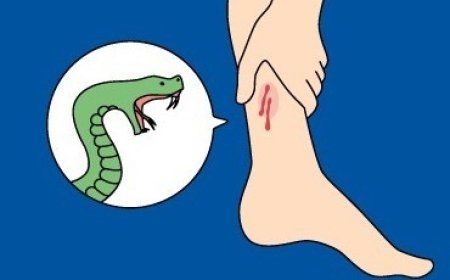 अछनेरा के स्कूल में सर्पदंश से पांचवीं की छात्रा की मौत, मामला रफा-दफा