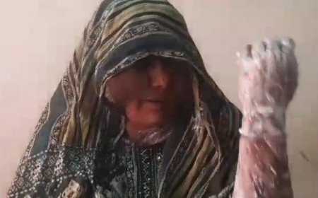 इकबाल ने अपनी पत्नी पर  डाला ज्वलनशील पदार्थ, झुलसी