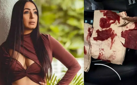 कश्मीरा शाह हो गईं दुर्घटना का शिकार