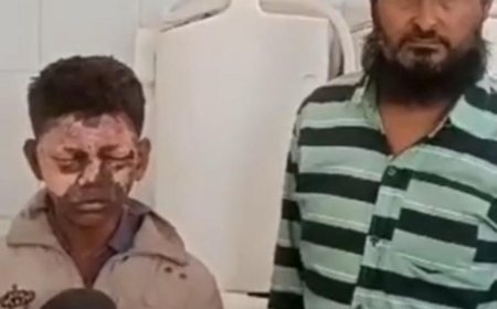 फुंकी आतिशबाजी से अचानक निकली चिंगारी, दो बच्चे बुरी तरह झुलसे 