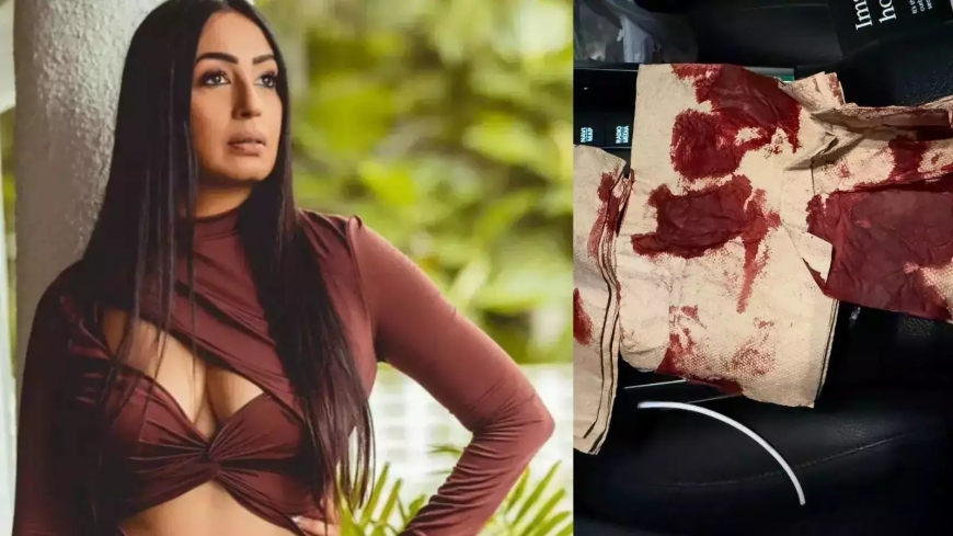 कश्मीरा शाह हो गईं दुर्घटना का शिकार