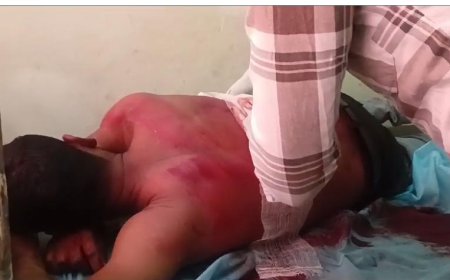 अछनेरा के कचौरा में युवक को गोली मारी, गंभीर घायल