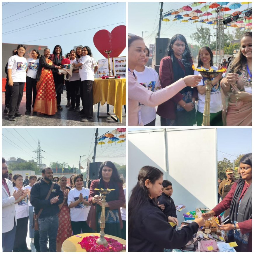 सेल्फी पॊइंट पर शिरोज फेयर शुरू, एडीए वीसी ने कहा- एसिट अटैक सरवाइवर्स से सीखें