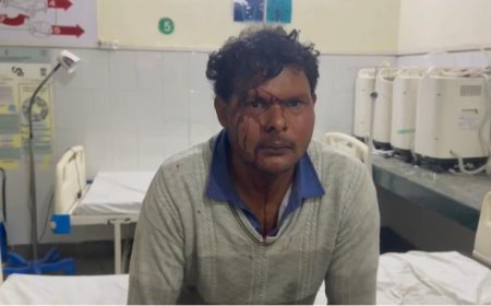 खुले में नहाती थी पत्नी, पति ने विरोध किया तो साले ने सिर फोड़ दिया