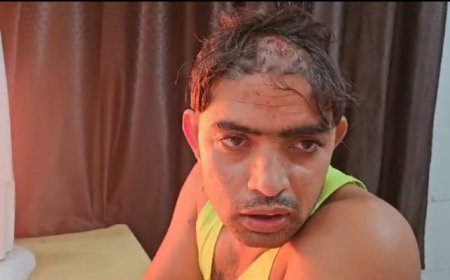 पति ने पत्नी और उसके भतीजे पर किया जानलेवा हमला, दोनों घायल