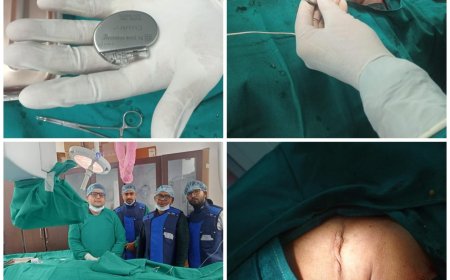 एसएन मेडिकल कॊलेज में पहला पेसमेकर लगाया गया