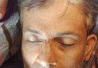 आगरा में झगड़े में घायल टेम्पो चालक की मौत, पत्नी ने दी हत्या की तहरीर