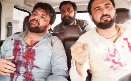 वीरू और राणा समेत दर्जन भर से अधिक घायल, इतने ही पुलिसकर्मी भी जख्मी