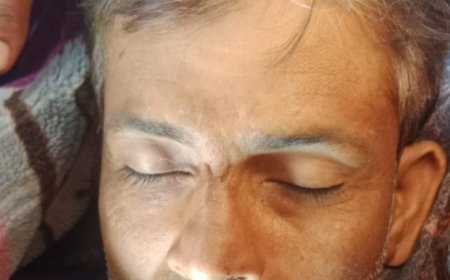 आगरा में झगड़े में घायल टेम्पो चालक की मौत, पत्नी ने दी हत्या की तहरीर