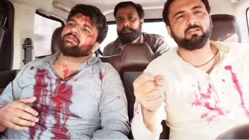 वीरू और राणा समेत दर्जन भर से अधिक घायल, इतने ही पुलिसकर्मी भी जख्मी