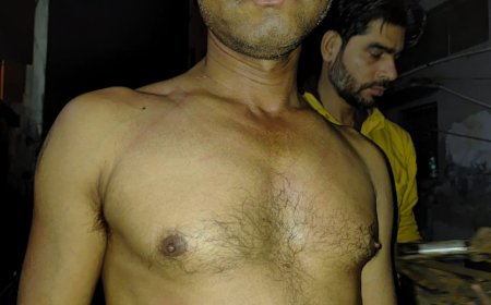 साईं की तकिया चौराहे पर दबंग ने चौथ के लिए ऑटो चालक को बेल्ट से पीटा