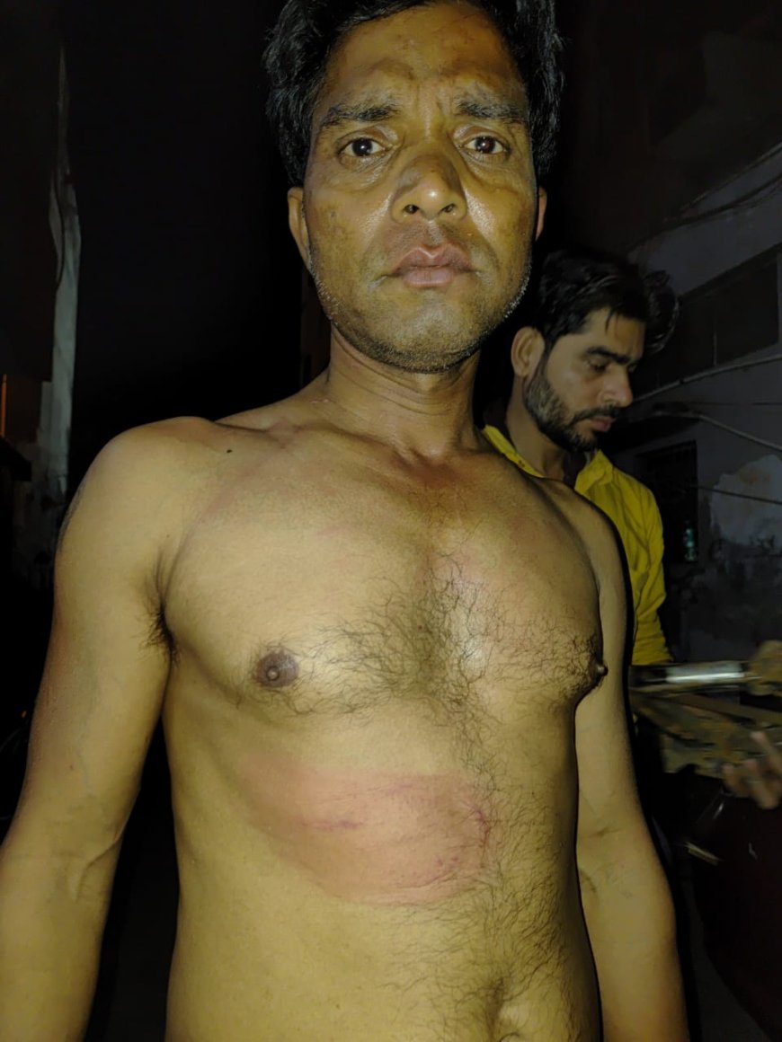 साईं की तकिया चौराहे पर दबंग ने चौथ के लिए ऑटो चालक को बेल्ट से पीटा