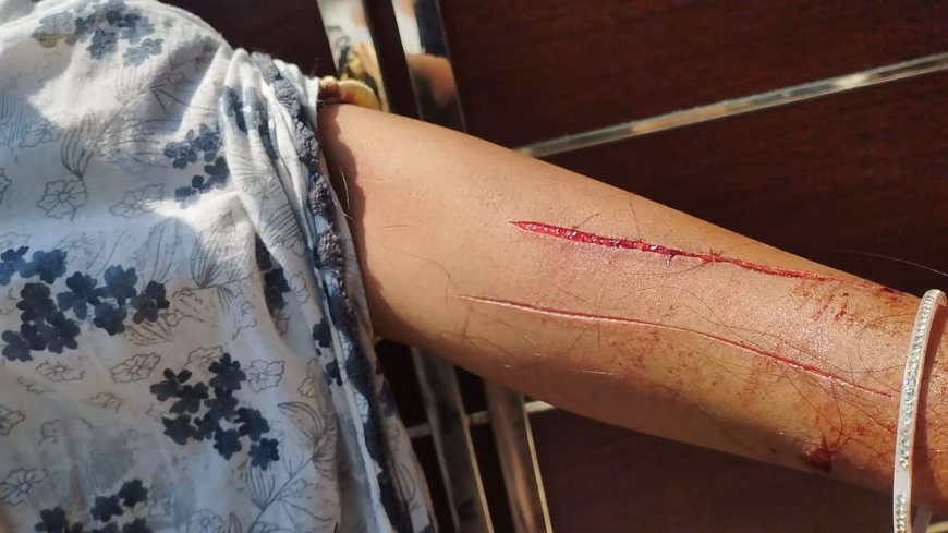 अधिवक्ता ने पत्नी को मारपीट कर बुरी तरह ज़ख्मी किया