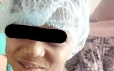 एसएन में दूरबीन विधि से नाक से ट्यूमर निकाल कर रचा इतिहास, चार घंटे चला ऑपरेशन