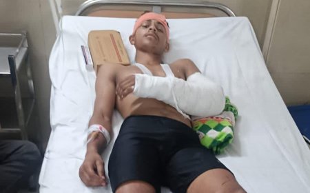 मगरमच्छ से भिड़ा चंबल का सपूत, नहाते समय हुआ हमला, ग्रामीणों ने बचाई जान