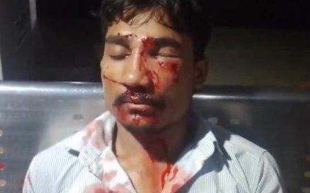 रेलवे ट्रैक बना लुटेरों का ठिकाना: चलती ट्रेन में पत्थर मारकर मोबाइल ले उड़े, युवक गंभीर घायल