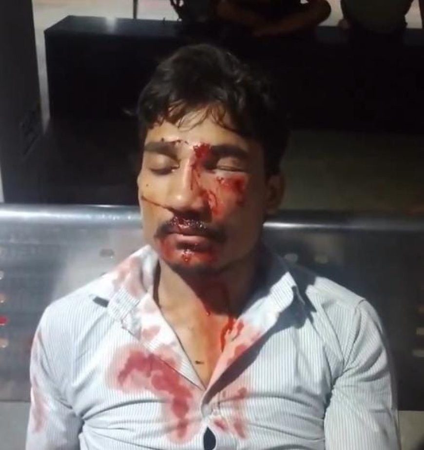 रेलवे ट्रैक बना लुटेरों का ठिकाना: चलती ट्रेन में पत्थर मारकर मोबाइल ले उड़े, युवक गंभीर घायल