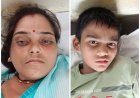 आगरा के भदरौली में डबल डेकर बस से टच हुई विद्युत लाइन, ड्राइवर समेत तीन को लगा करंट
