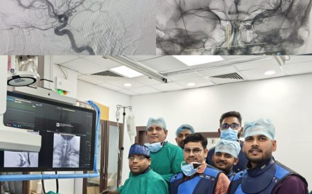 एसएन मेडिकल कॉलेज की ऐतिहासिक छलांग: आगरा में पहली बार मस्तिष्क की डिजिटल एंजियोग्राफी सफल
