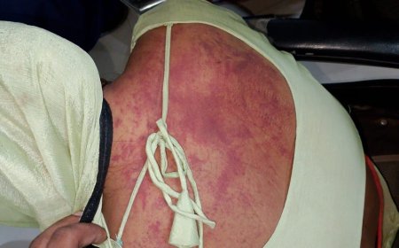 आगरा में भूत का साया बताकर बेटी को ससुराल से ले गया था पिता, अधमरी हालत में छोड़ गया