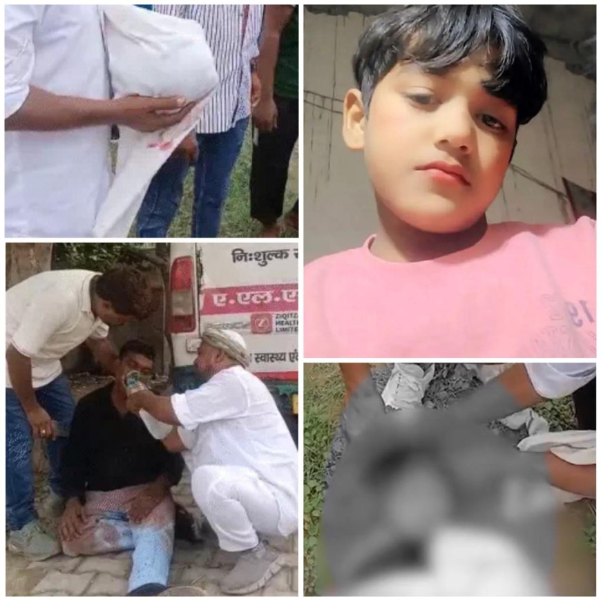 हाथरस में बरात की बस में 11 साल के बच्चे का सिर धड़ से अलग हुआ