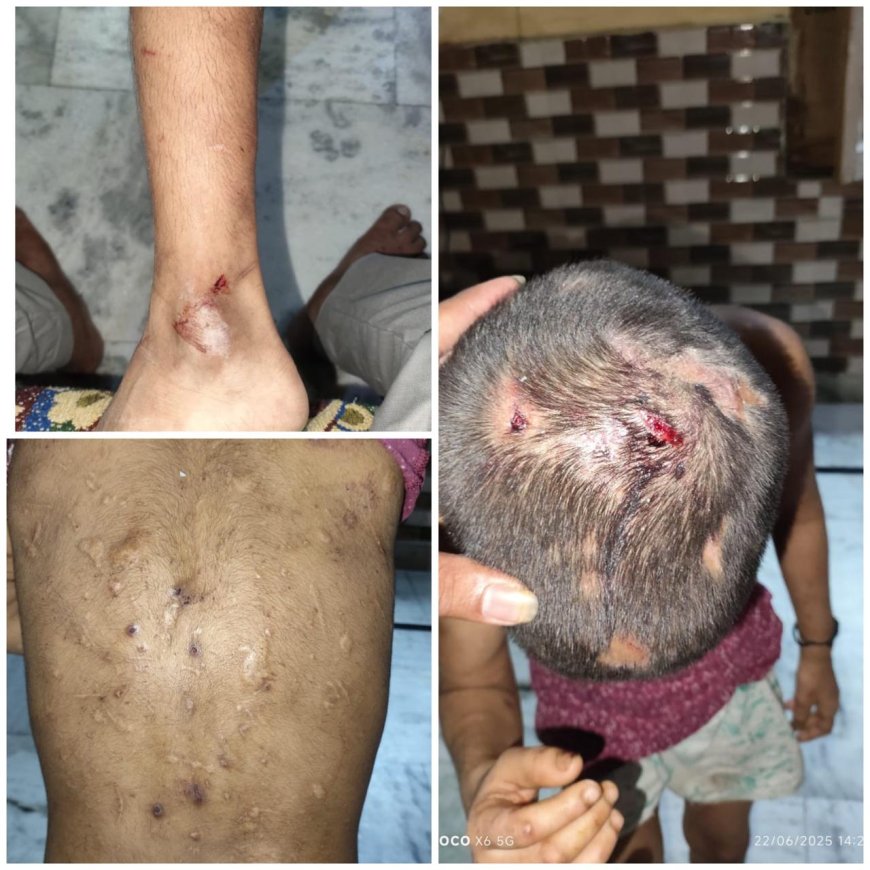 नौ साल की बालिका चौकी पहुंचकर बोली- मुझे बचा लो, मुझे पीटते हैं और धंधा कराते हैं