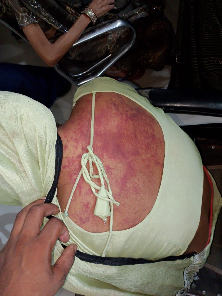 आगरा में भूत का साया बताकर बेटी को ससुराल से ले गया था पिता, अधमरी हालत में छोड़ गया