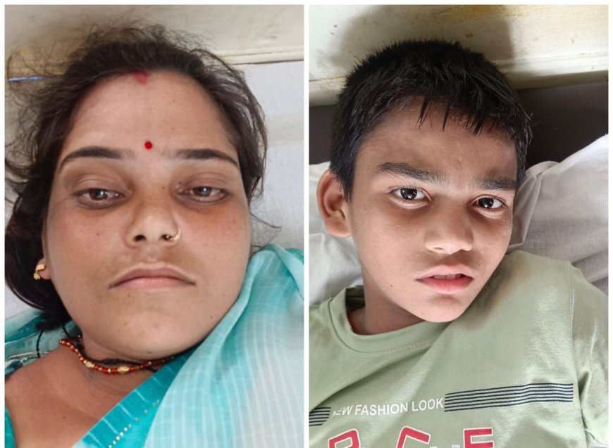 आगरा के भदरौली में डबल डेकर बस से टच हुई विद्युत लाइन, ड्राइवर समेत तीन को लगा करंट