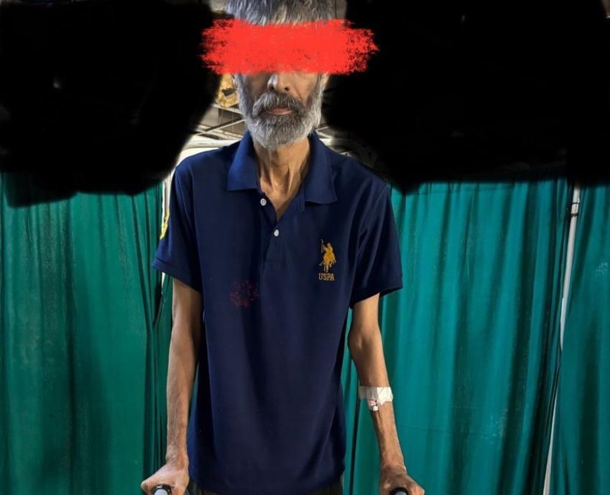 एसएन मेडिकल कॉलेज में कूल्हा प्रत्यारोपण की जटिल सर्जरी सफल, मरीज को मिला नया जीवन