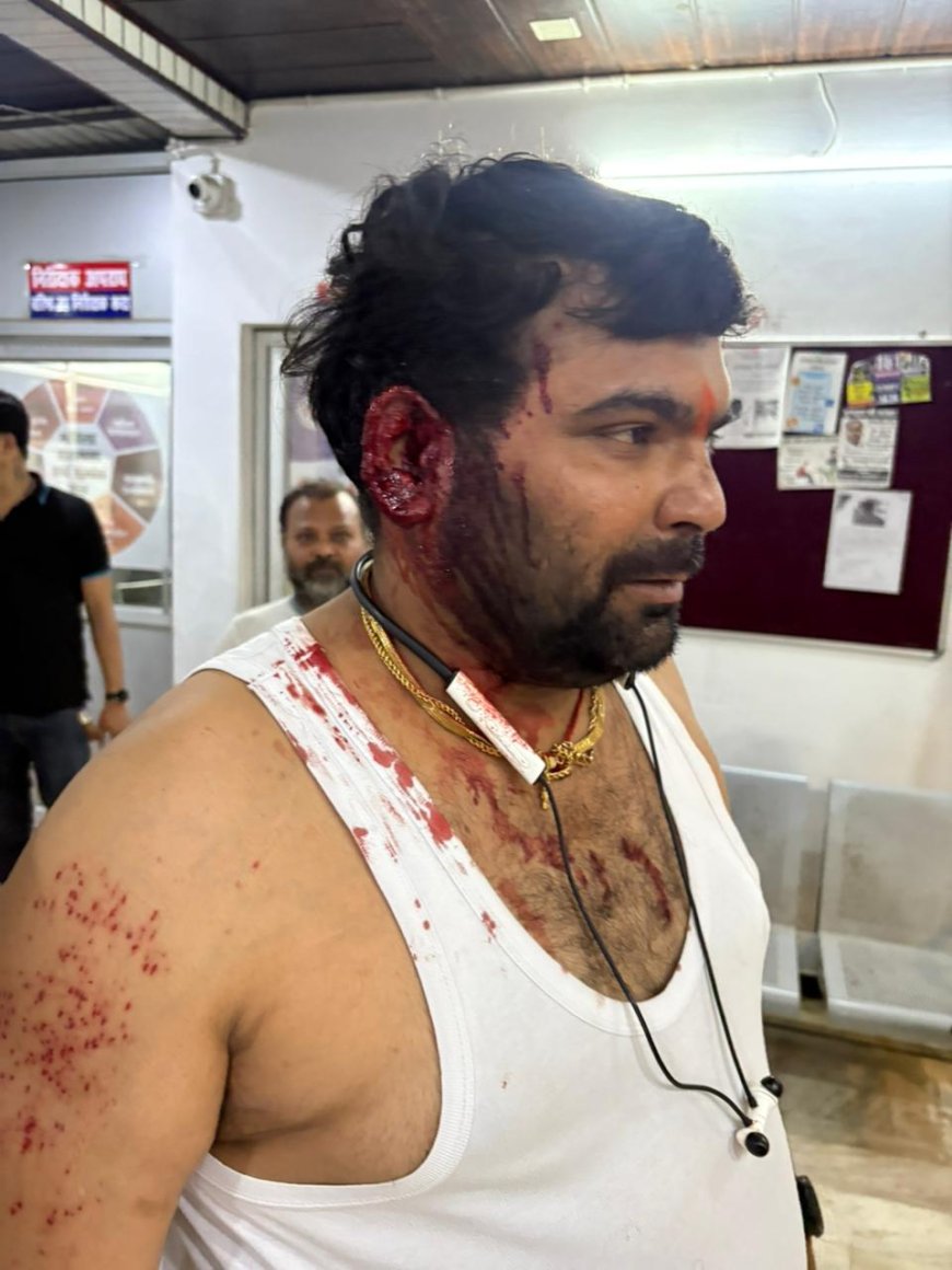 भाजपा नेता पर हमले का मुख्य आरोपी सोहेल अभी पकड़ से बाहर, पुलिस की छापेमारी जारी