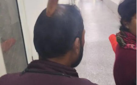 आगरा में जानलेवा हमला, बाइक सवारों ने चलती स्कूटी पर बरसाई सुम्मी, सिर में धंसी लोहे की नुकीली रॉड