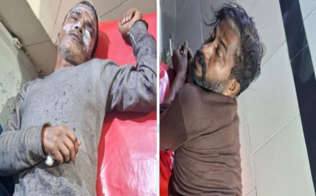 आगरा के इंडस्ट्रियल एरिया में केमिकल गोदाम में धमाका, चार लोग झुलसे, गेट बंद कर अंदर जाने पर रोक