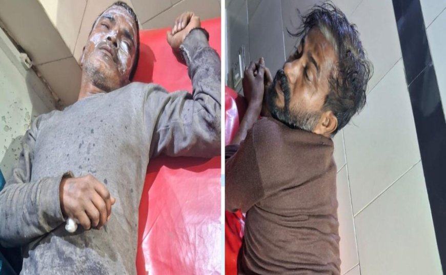 आगरा के इंडस्ट्रियल एरिया में केमिकल गोदाम में धमाका, चार लोग झुलसे, गेट बंद कर अंदर जाने पर रोक