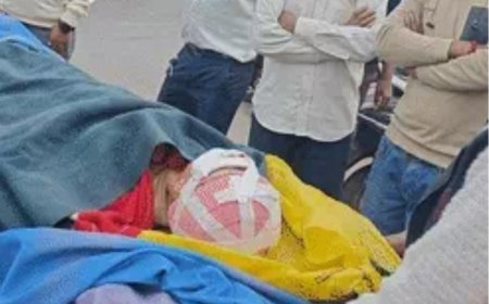 आगरा में रिश्तों को शर्मसार करने वाली वारदात, सरप्राइज गिफ्ट के बहाने भाभी ने ननद पर किया जानलेवा हमला, 50 से ज्यादा वार