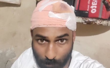 आगराः रॉन्ग साइड पर माफी के बावजूद पुलिसकर्मियों ने युवक का सिर ऑटो में दे मारा, शांति भंग में चालान भी कर दिया