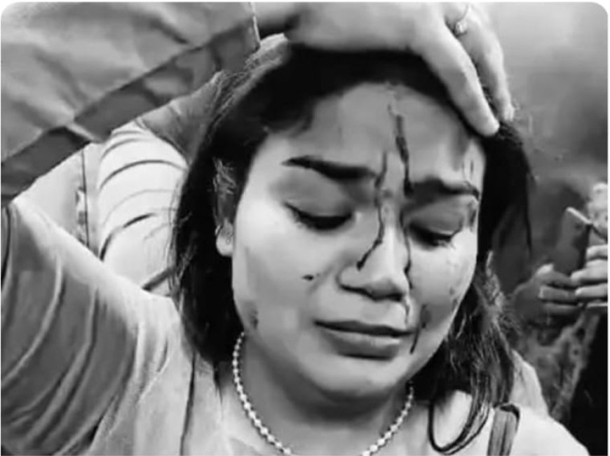 बरेली में हाई प्रोफाइल हंगामा: माई बार हेडक्वार्टर की क्रिसमस पार्टी में बोतलबाज़ी, युवती घायल, राइस मिल मालिक की बेटी व बॉयफ्रेंड पर केस