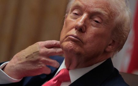 चौकों-छक्कों से बैकफुट तक: अमेरिकी राष्ट्रपति को आखिर हुआ क्या है?  कोई सुनता क्यों नहीं ट्रंप चचे की!