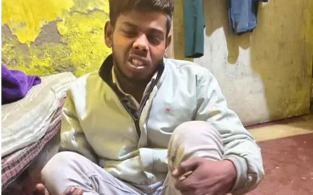खाकी पर फिर दाग, दूध बेचने वाले युवक को थर्ड डिग्री, नाखून उखाड़े जाने का आरोप, दरोगा निलंबित