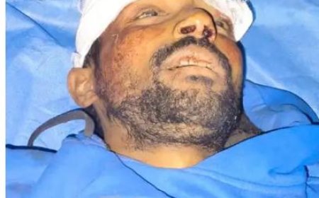नशे और रफ्तार का कहर, कोठी मीना बाजार में कार ने स्कूटी को रौंदा, एक युवक की मौत, दो की हालत गंभीर