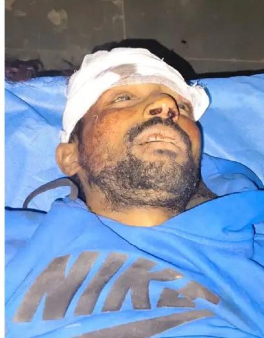 नशे और रफ्तार का कहर, कोठी मीना बाजार में कार ने स्कूटी को रौंदा, एक युवक की मौत, दो की हालत गंभीर