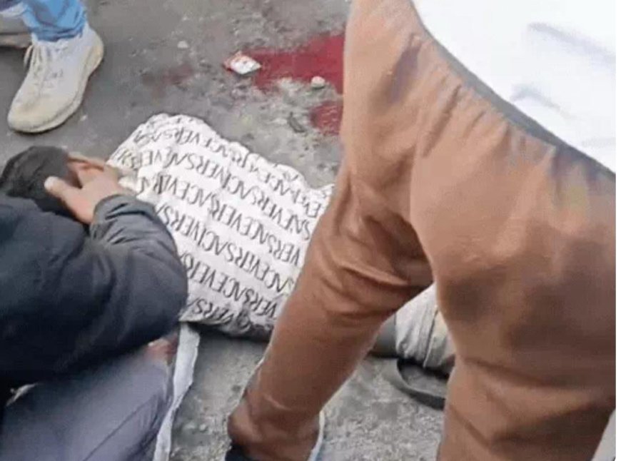 बोदला में गुब्बारे बेच रहे युवक के साथ बड़ा हादसा, हीलियम सिलेंडर फटा, पैर गंभीर रूप से घायल