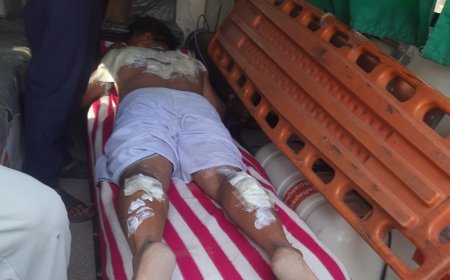 आगरा के पिनाहट क्षेत्र में आलू खुदाई के दौरान किसान पर गिरा जर्जर हाईटेंशन विद्युत तार, गंभीर रूप से झुलसा, परिजनों का खेत में ही धरना