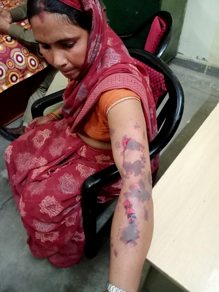 फतेहपुर सीकरी क्षेत्र में दो घटनाएं: मामूली विवाद में दो पक्ष भिड़े, हाईवे हादसे में युवक घायल