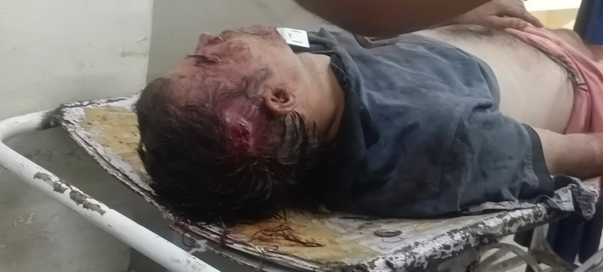 आगरा में रिश्तों का कत्ल, हिस्से के झगड़े में छोटे भाई ने बड़े भाई को पीट-पीटकर  मार डाला, परिवार में मचा कोहराम