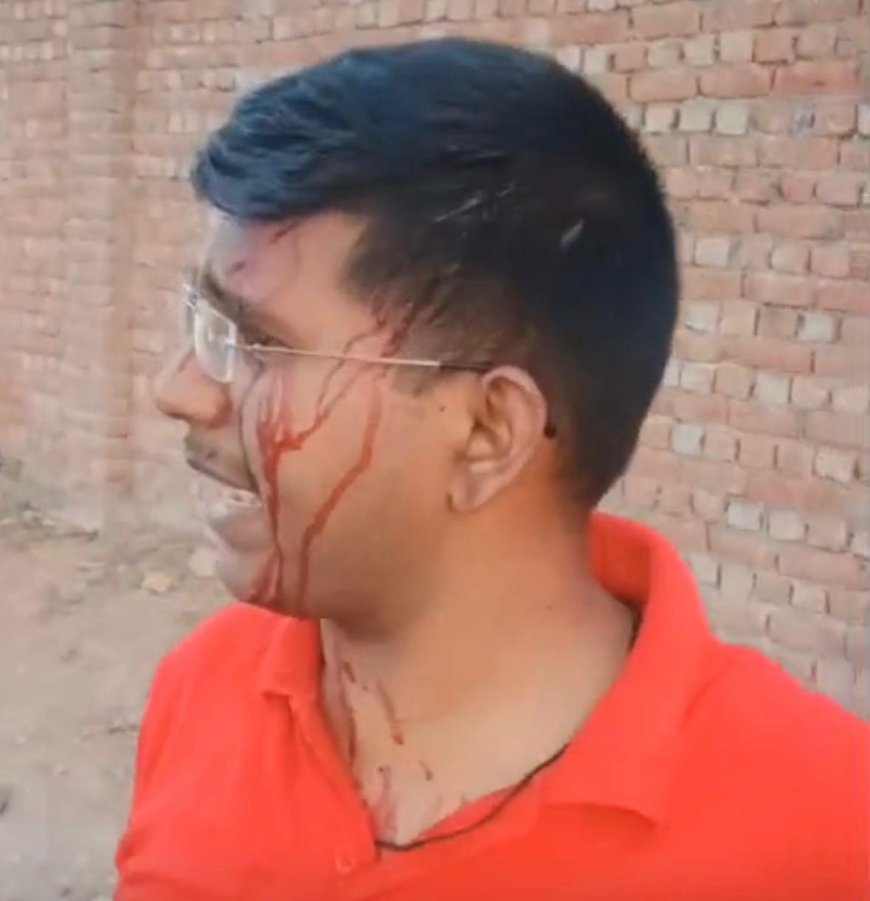 विवि का छलेसर कैंपस बना रणक्षेत्र, छात्र का सिर फोड़ा, कुलपति ने एफआईआर और डिबार की कार्रवाई के दिए आदेश